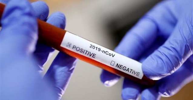 SON DAKİKA: Rusya'nın Covid-19 Aşısı Onay Aldı