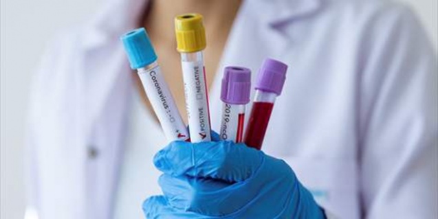 Seminere Katılan Öğretmenlerin Testi Pozitif Çıktı!