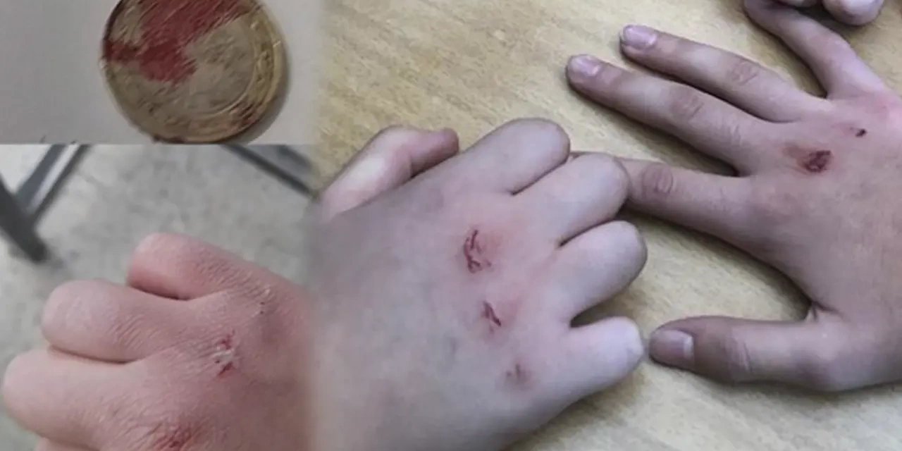 Öğretmenlerin Gözünden Kaçmaması Gereken Bir Tehlike: Kalıcı Hasara Yol Açan Oyun