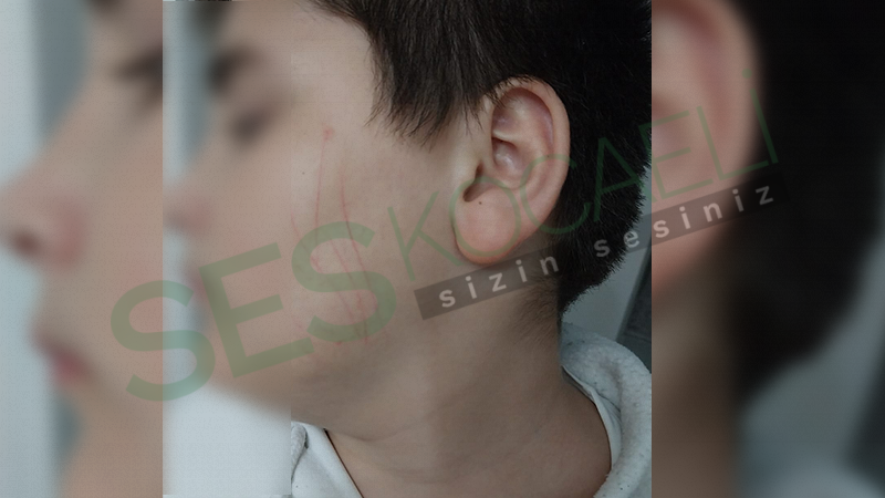 Öğretmen Kitabı Unutan Öğrencinin Yanağını Kırmız Kalemle Çizdi.Veli Şikayet etti.