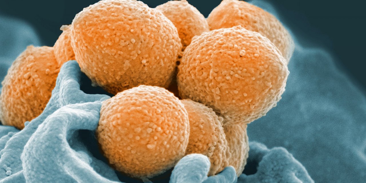 Strep A Paniği Devam Ediyor!Ölü Sayısı 8'e Yükseldi.