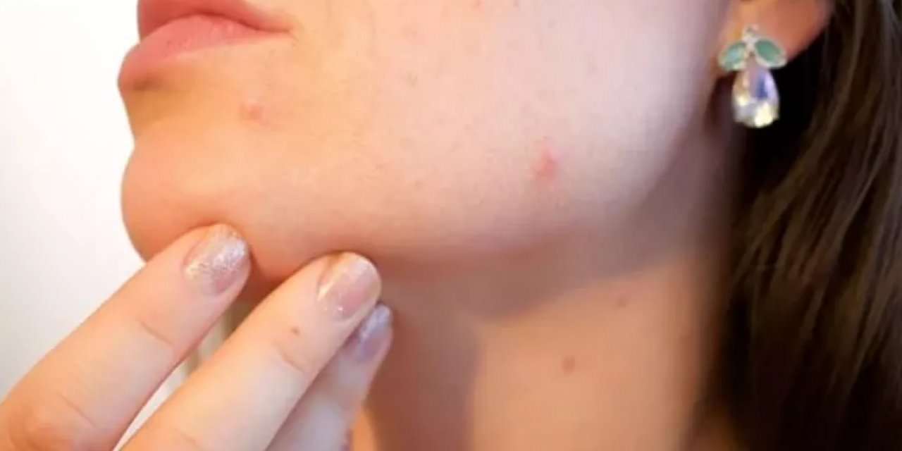 Kanserde Sıradışı Belirtiler Devrede! Kimse Bunu Tahmin Etmiyor!