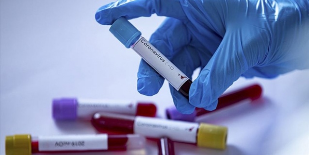 Hastaneden Kaçan Covid-19 Hastasını...