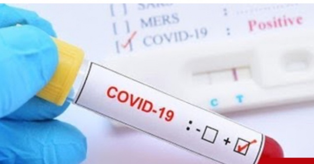 MSÜ Sınavında Covid-19’lu Aday Tespit Edildi